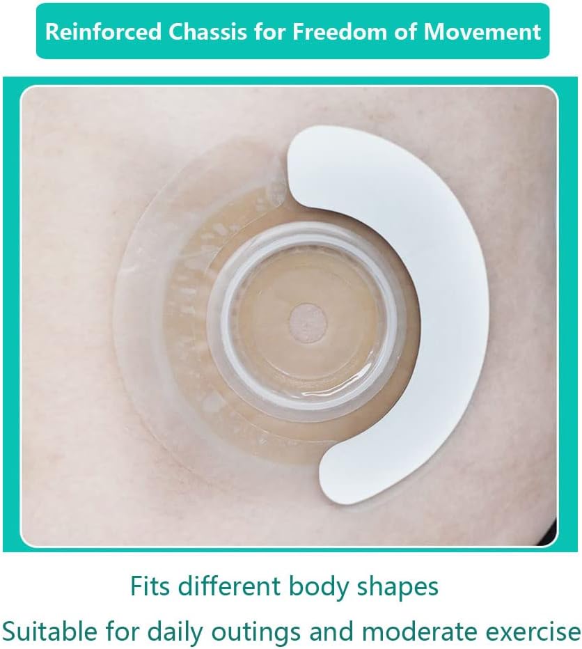 Buy 20PCS Ostomy Supplies,Ostomy Barrier Strips Elastic Barrier Strips