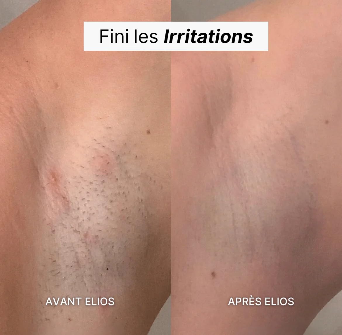 Rasoir Elios Femme 5 En 1, Rasoirs Électriques Femme, Epilateur Visage Femme avec Affichage, 5 têtes interchangeables Tondeuse Bikini 5 En 1 Étanche IPX7, Aisselles, Pour Bikini, Jambes, Nez (Blanc)