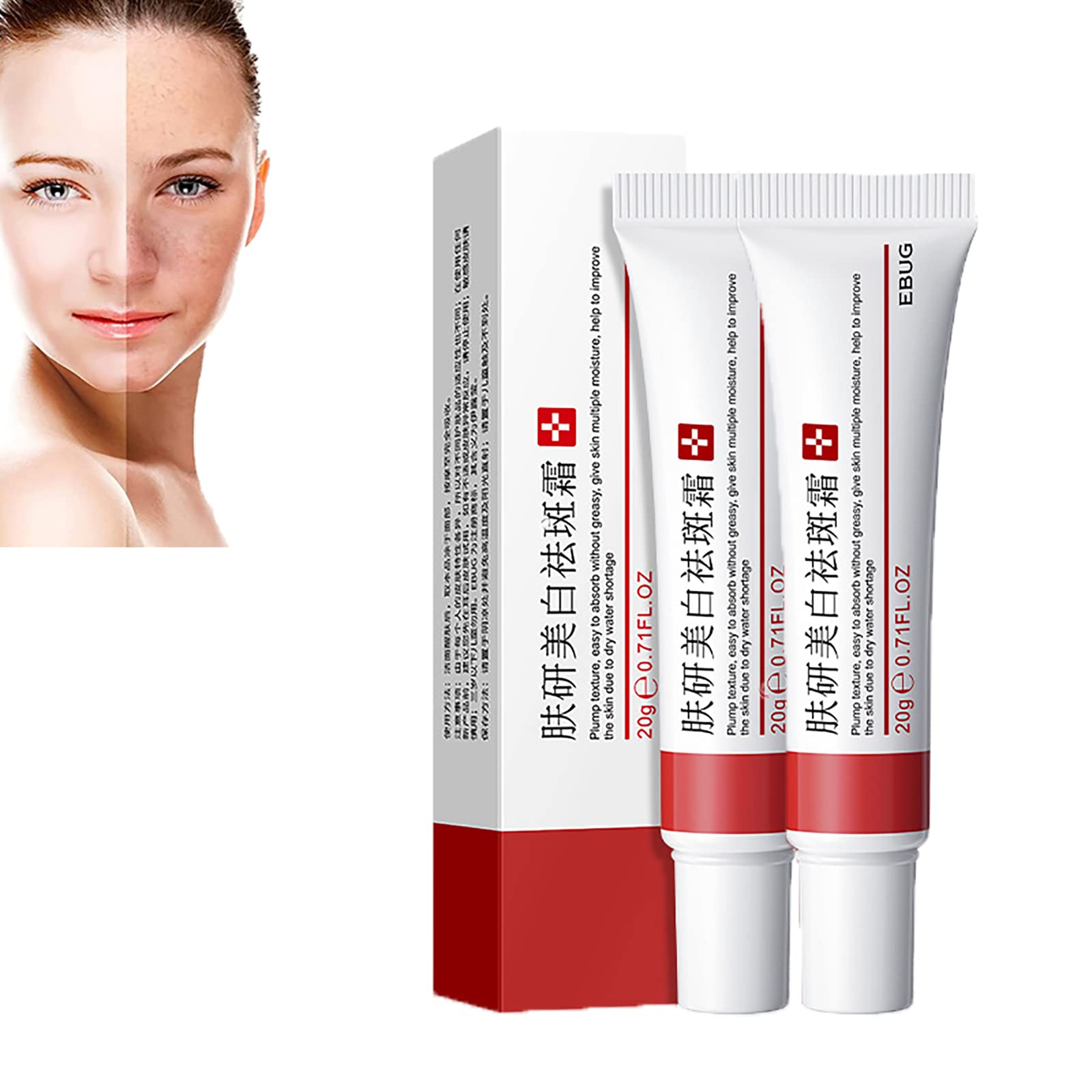 Whitening Freckle Cream,Acne Scar Removal Treatment Cream,Pigmentation Removal Cream For Face,Remove Melasma Acne Cream Fading Spot Cream,Dark Spot Corrector For Face (2PCS,Whitening Freckle)