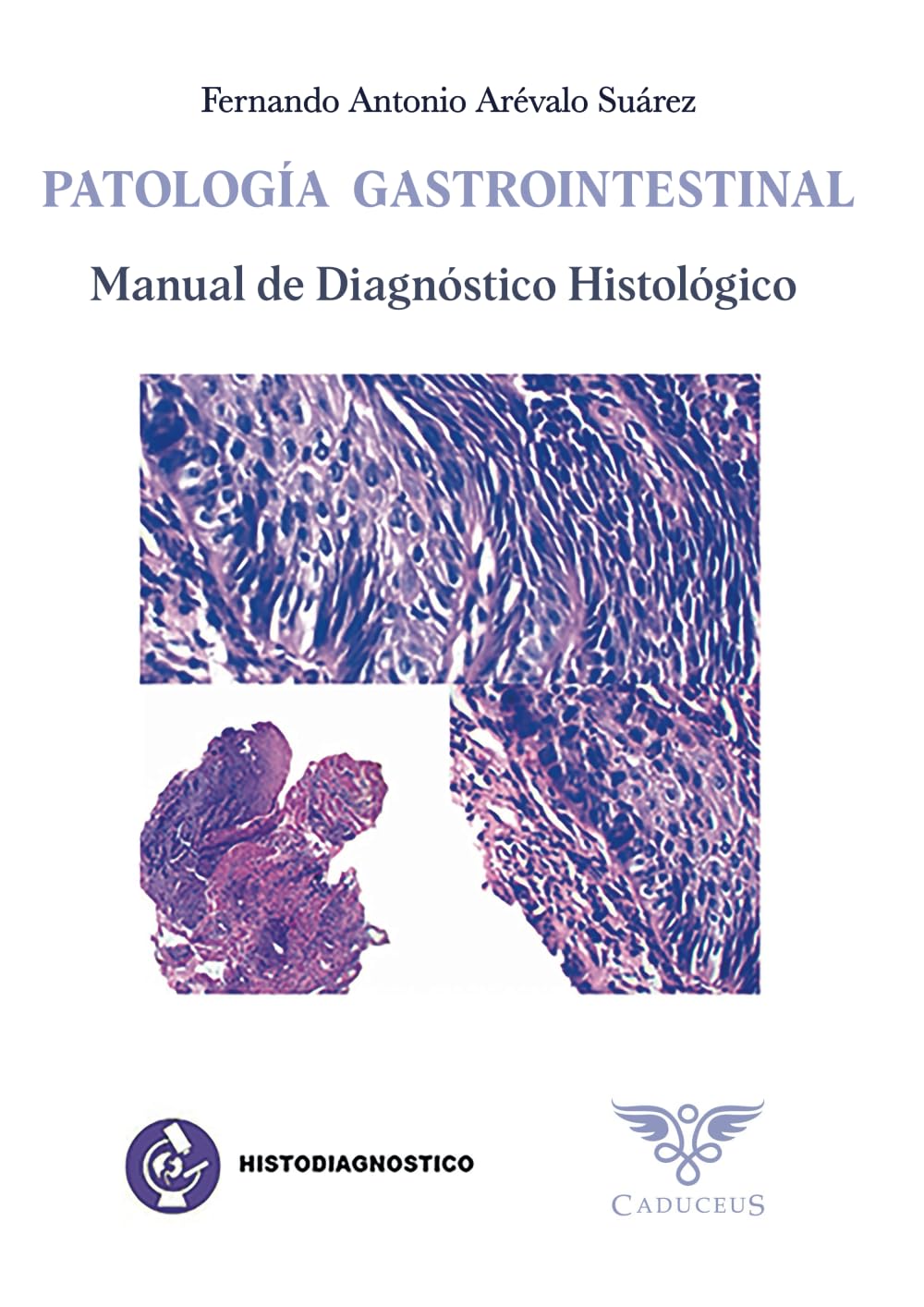Histodiagnóstico: Patología gastrointestinal