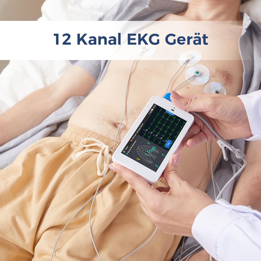 Wellue PG12 ECG professionale a 12 derivazioni, dispositivo ECG digitale con algoritmo di Glasgow, acquisizione e analisi dei dati ECG in tempo reale, trasferimento dati WIFI e stampa dei report