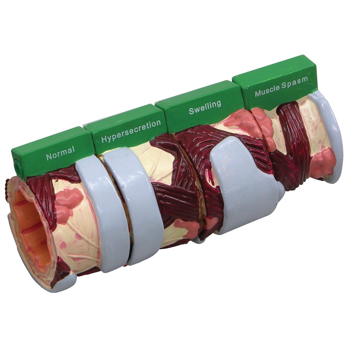 GPI Anatomicals Modelo de bronquio de 4 piezas