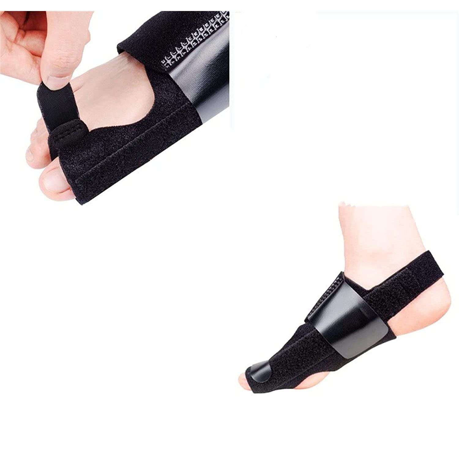 1 paio di correttori per alluce valgo regolabili con cintura per la correzione della punta dell'osso del piede grosso, kit di maniche protettive per il sollievo del tutore per stecche