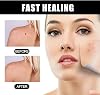 Aobenz Whitening and Freckle Removing Essence (3Pcs)