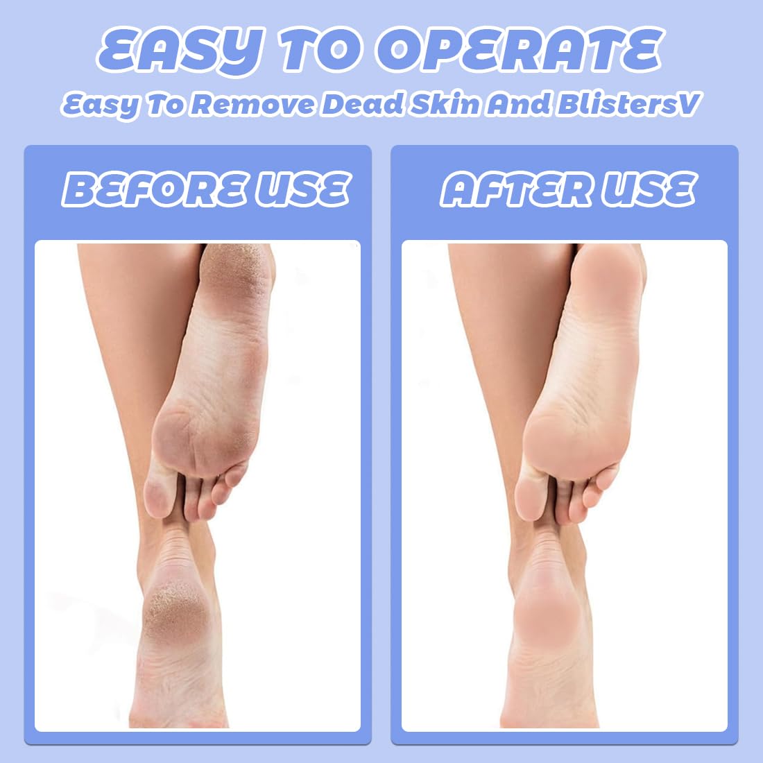 Pietra Pomice Doppia Azione, 2 pezzi, spugne per la pulizia dei piedi, Elimina la pelle dura e i calli da piedi e mani e li rende morbidi e setosi, per Dura Morta Bagno Doccia Trattamento Giornaliero