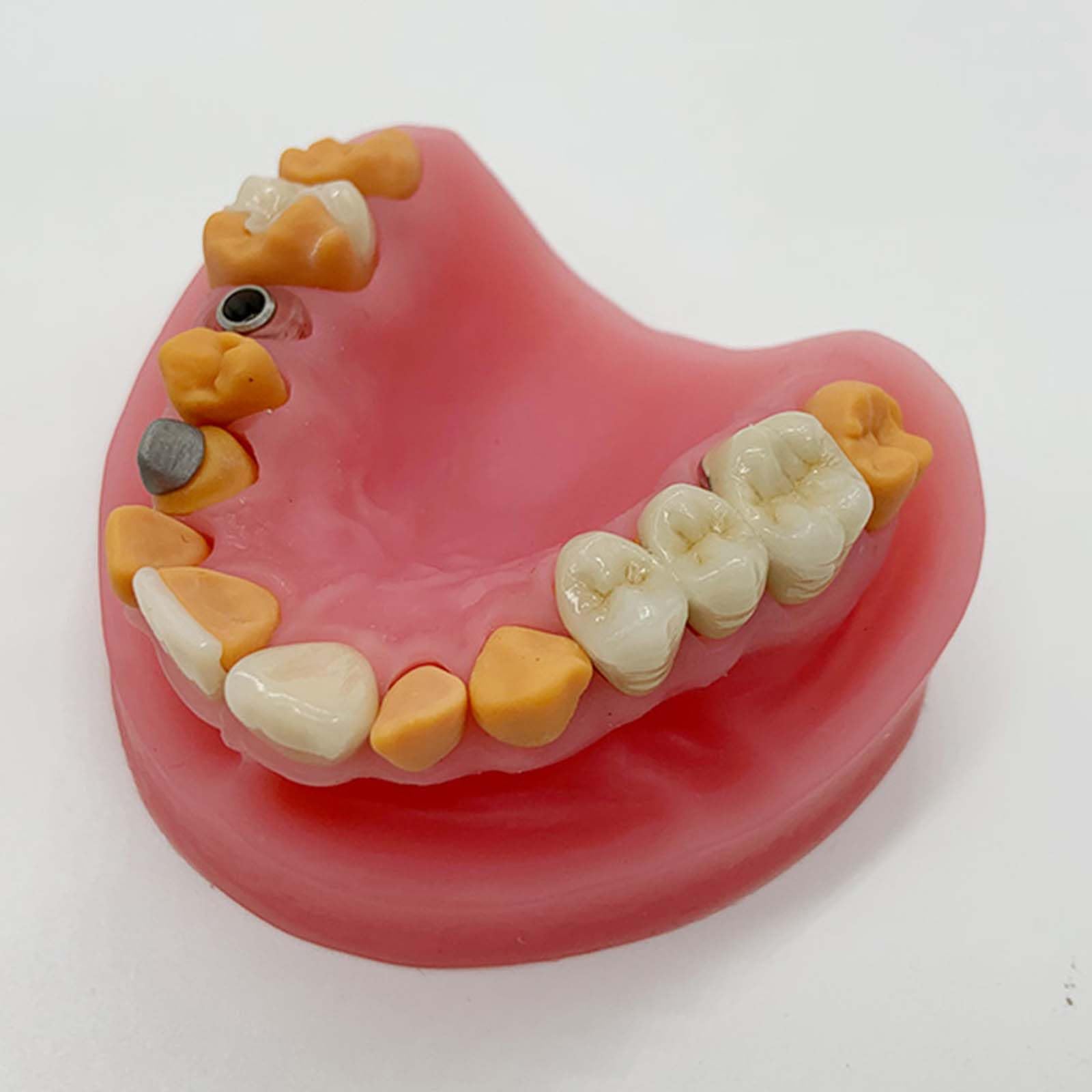 Modello espositivo per Protesi Dentarie, manichino Dentale, Modello didattico per odontoiatria Orale, stampi per odontoiatria Orale