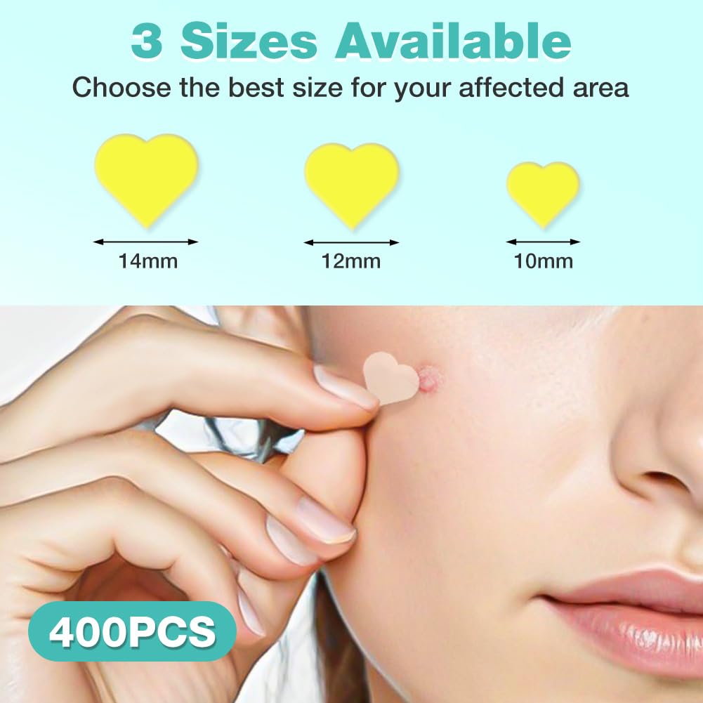 BUTBU Pimple Patches, 400 Pieces Heart Hydrocolloid Spot Patches, Mighty Blemish Patches - Image 2