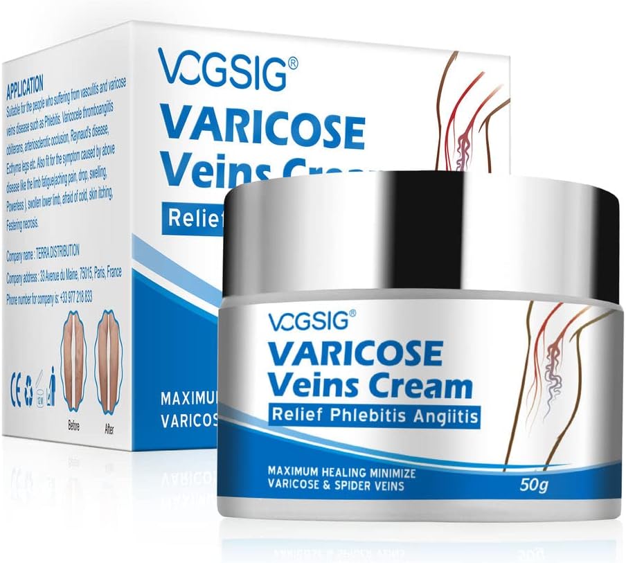 Varicose Veins Cream, Soothing Leg with Natural Ingredients, Improves Blood Circulation of Spider Veins, Improve Pain of Legs - 50g