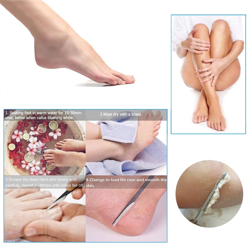 Cuchillo de Pedicura, Removedor de Callos Para Pies, Lima de Pie de Maíz de Piel, Cuchillo de Pedicura, Lima de Pie Raspador de Callos, Raspador Removedor de Callos de La Piel, Raspador de Pedicura