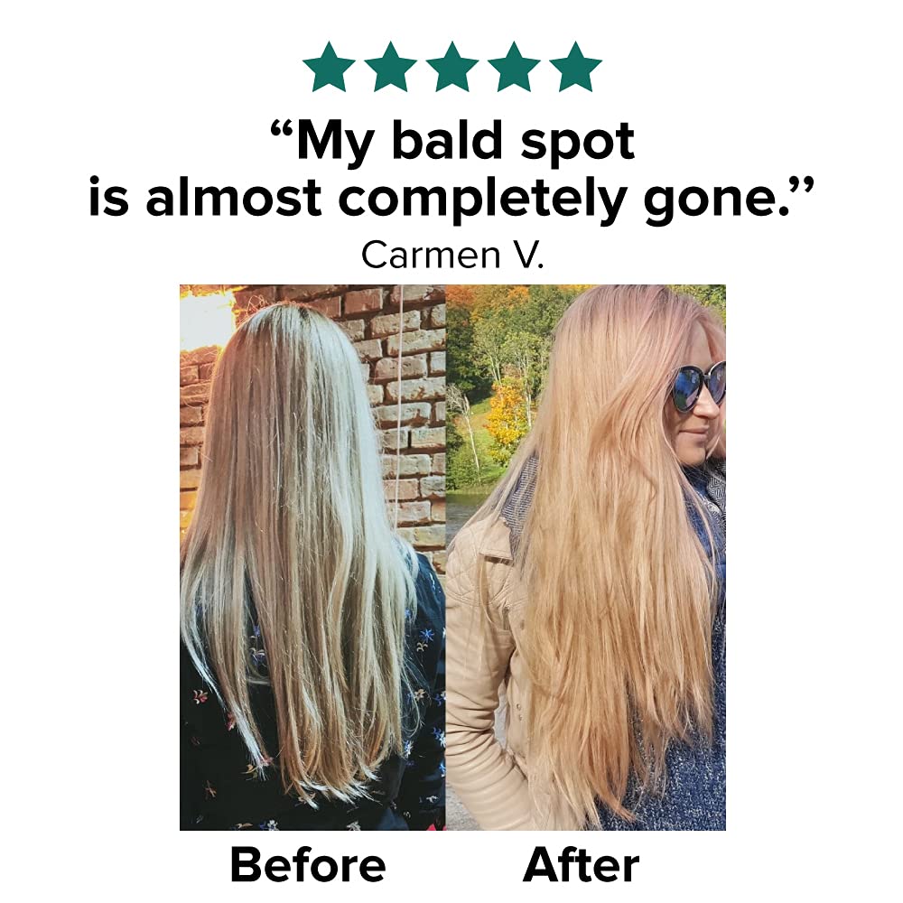 moerie hair growth reviews