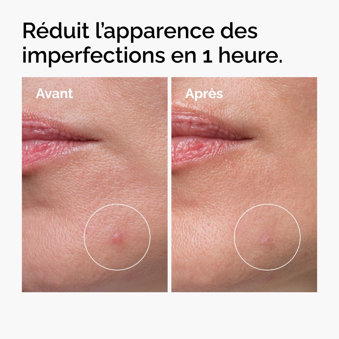 The Ordinary Concentré Crème-en-Poudre de Soufre 10%, Traitement ciblé des imperfections, permet de réduire l'apparence des éruptions cutanées, 5 g