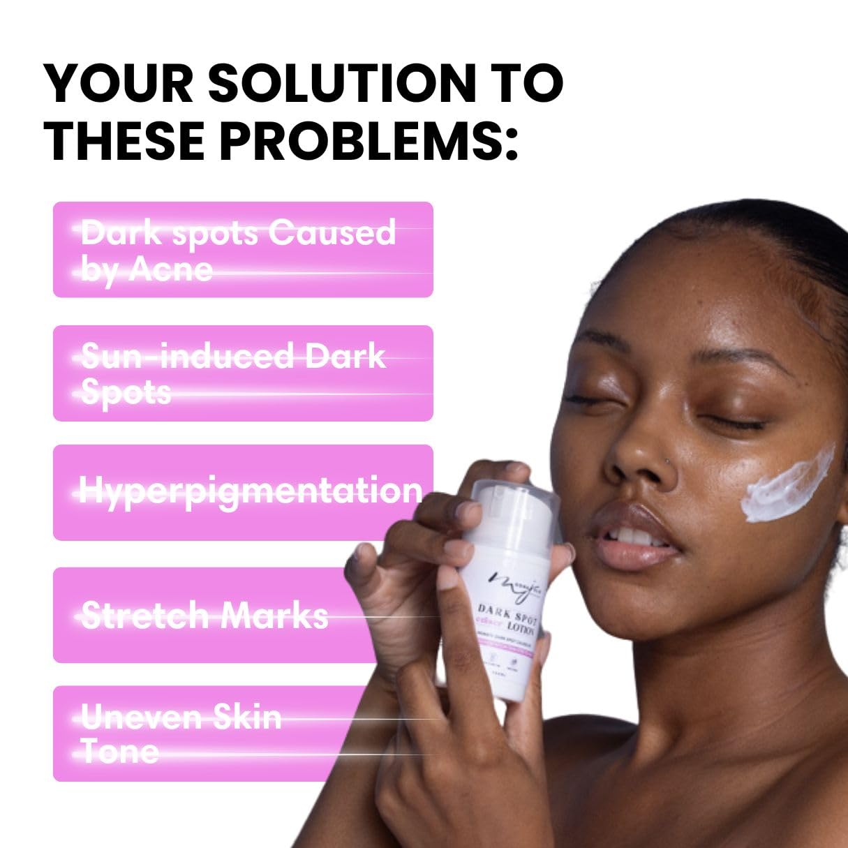 Moona Jolie Dark Spot Eraser Skin Nourishing Lotion - Hydrating Lotion for Face & Body - Improves Appearance of Acne Scars, Stretch Marks & Uneven Skin Tone with Vitamin C (250ML)