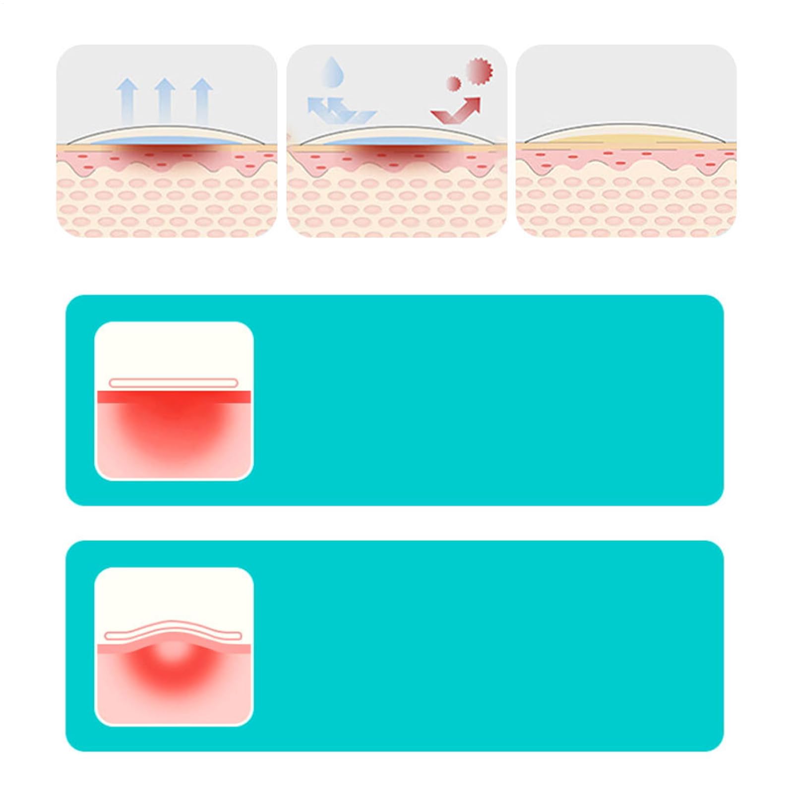 Cerotto Idrocolloide Cerotto Traspirante Flessibile Delicato Sensibile per | Medicazione Idrocolloide Cura Incisioni Pelle Sensibile Brufoli Viso Dita Tallone Piede Nuoto U