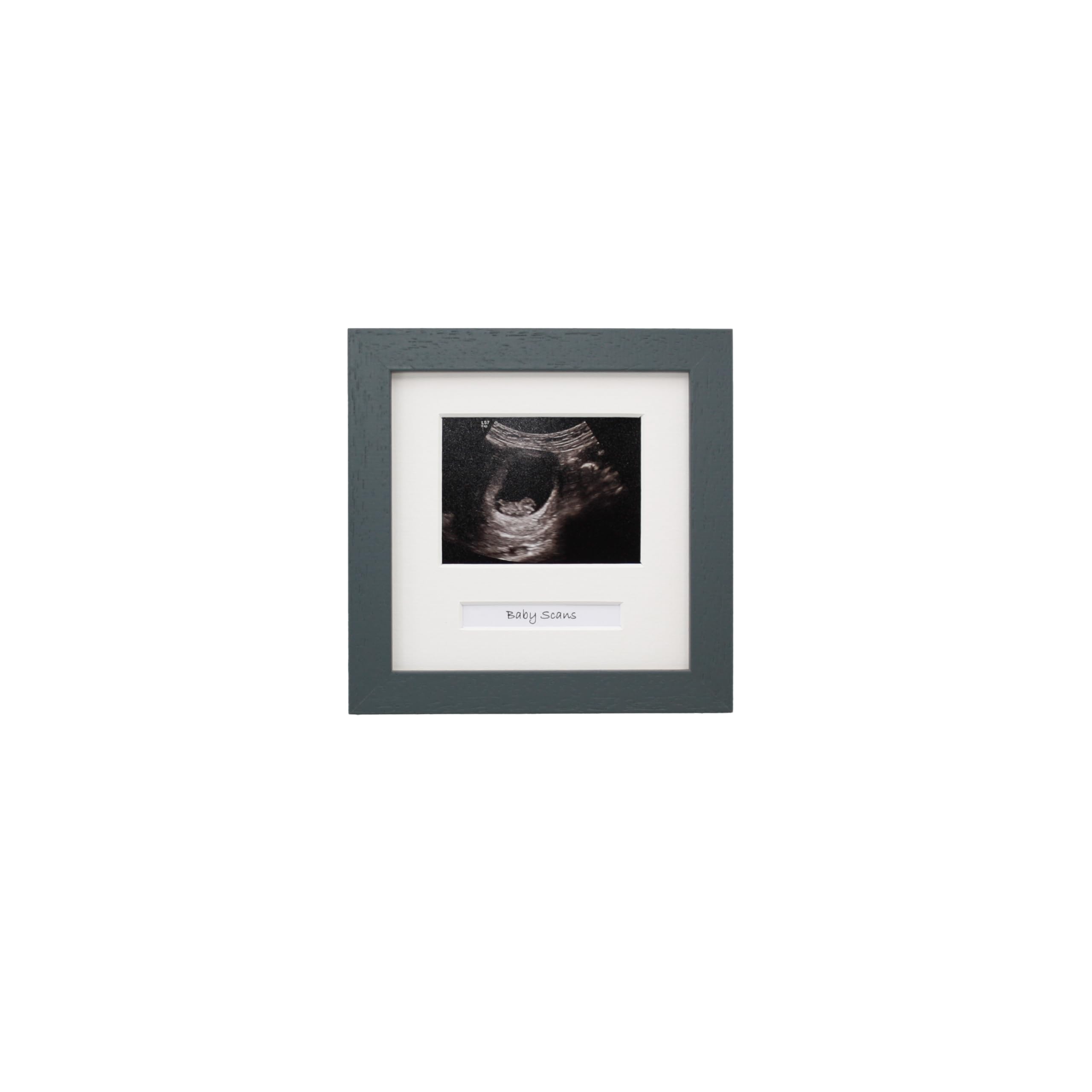 Baby Scan Photo Frame. Optional Personalisation. Multi Aperture Frame to display One Ultrasound photograph. Pregnancy announcment | Baby Shower | Pregnancy Keepsake (Dark Grey Frame)