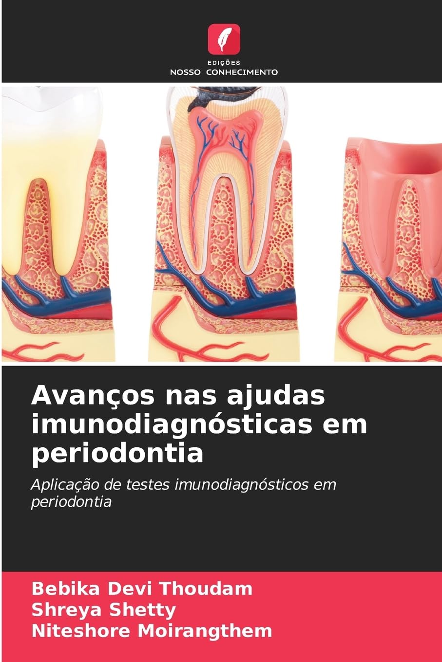 Avanços nas ajudas imunodiagnósticas em periodontia: Aplicação de testes imunodiagnósticos em periodontia