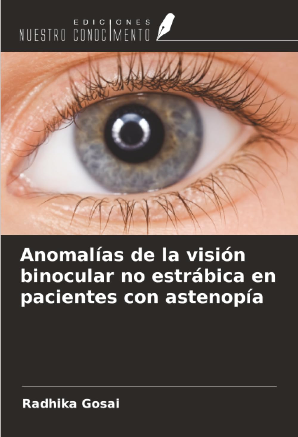 Anomalías de la visión binocular no estrábica en pacientes con astenopía