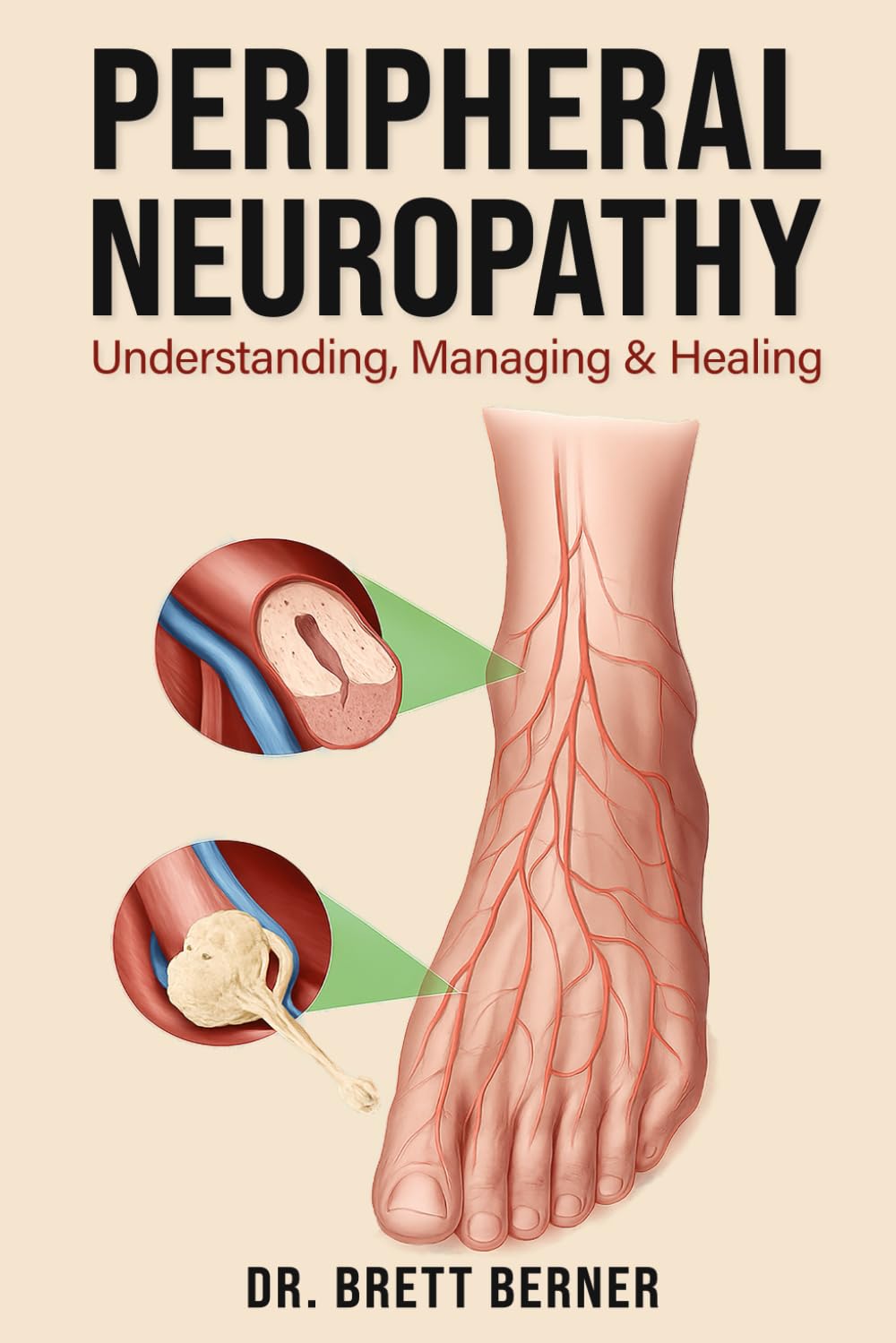 Peripheral Neuropathy: Understanding, Managing & Healing