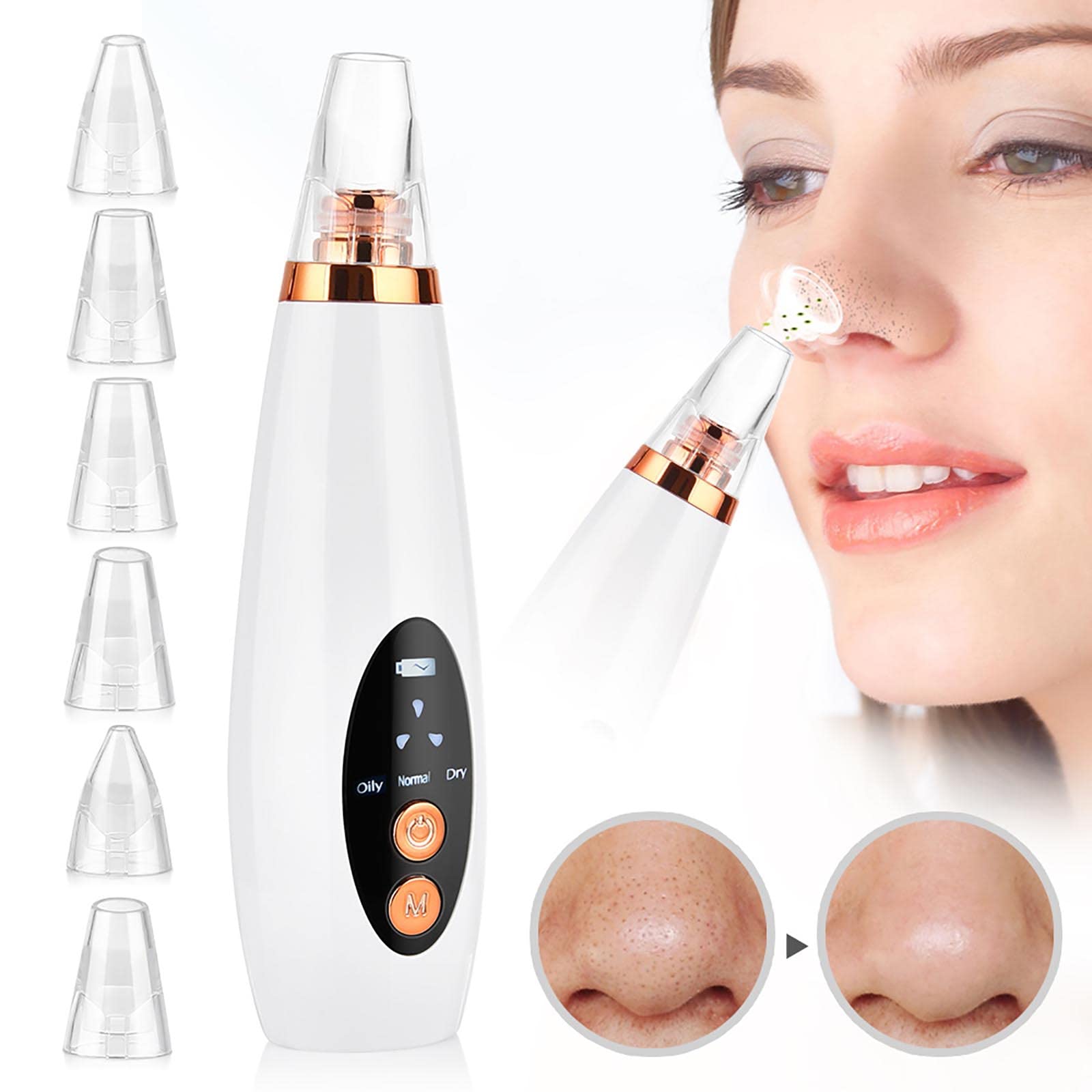 Limpiador facial de poros – Aspirador de poros para eliminar puntos negros, herramienta extractora de puntos blancos de comedones de acné, herramienta de succión de puntos negros, extractor de