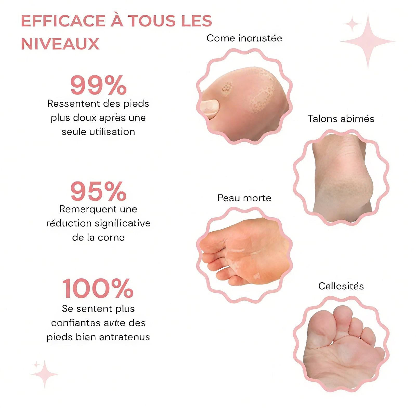 Honey Glow Pied, Mielle Ponceuse Pied, Rape Pieds Électrique, Avec 60 Tampons Glide Pour Éliminer Efficacement Et Sans Douleur Les Callosités,honeyglow kit beauté pieds
