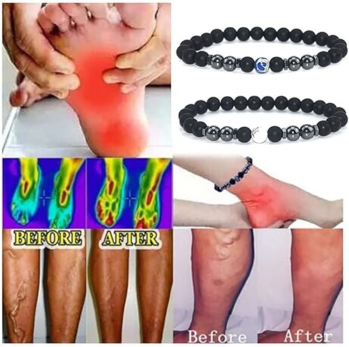 Miniatura 3 de Pulsera tobillera de obsidiana negra antihinchazón, tobillera ajustable para terapia de hematita para mujer, pulsera de tobillo antiansiedad, 2