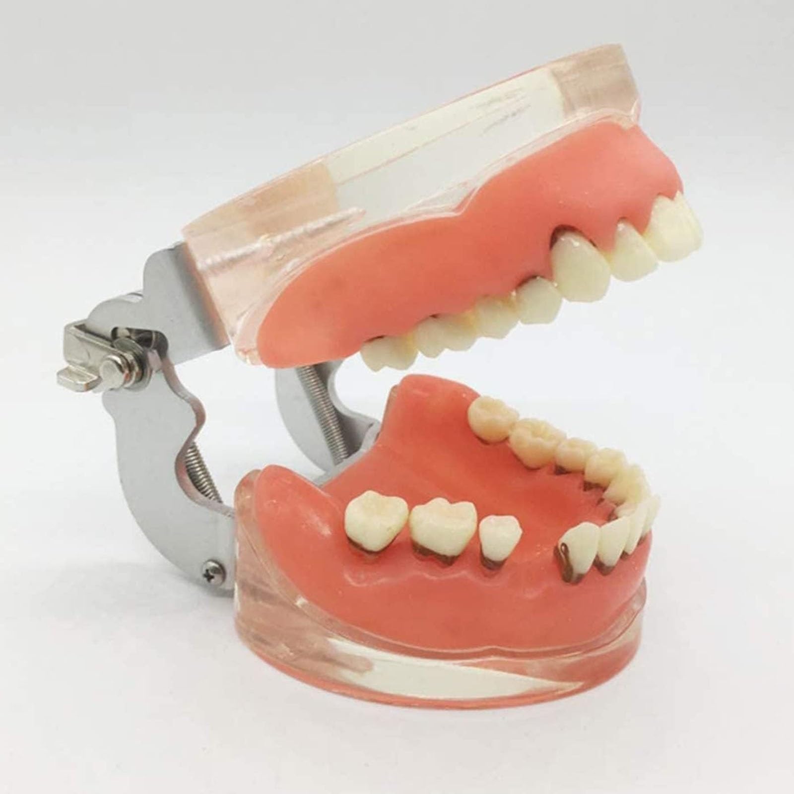 Modèle de dents pour maladies parodontales pour l'éducation, modèle d'enseignement anatomique avec gencives molles et dents amovibles pour démonstrations et entraînement dentaire