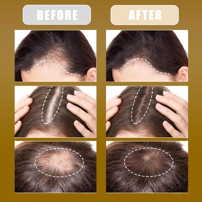 Miniatura 5 de Aceite de batana para el crecimiento del cabello, aceite natural de Honduras, máscara de batana para pérdida de milagro, repara dañado, deja más