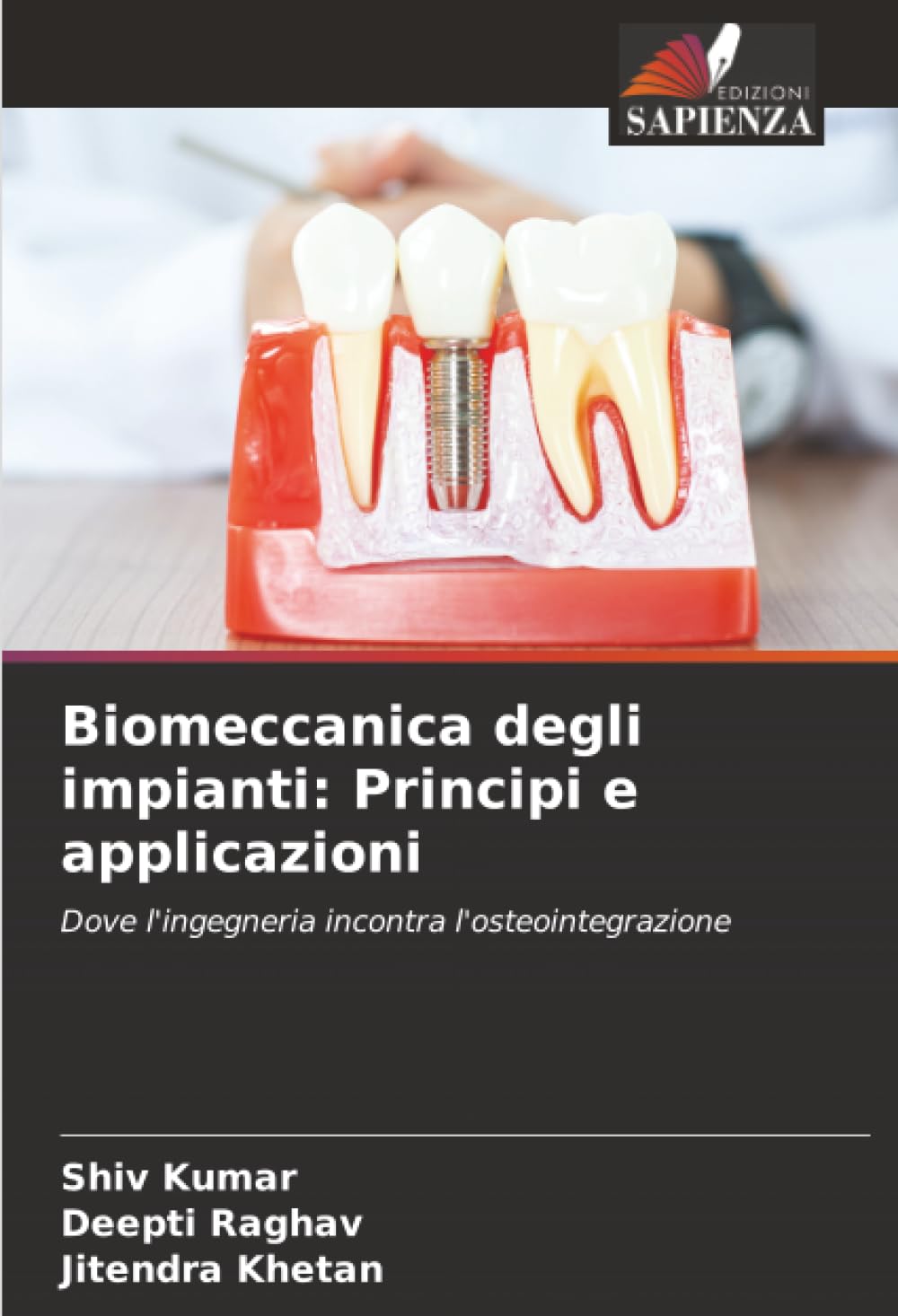 Biomeccanica degli impianti: Principi e applicazioni: Dove l'ingegneria incontra l'osteointegrazione
