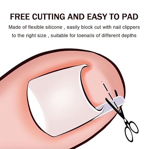 Miniatura 3 de El tratamiento de uñas encarnadas incluye 60 tiras correctoras de uñas encarnadas, levantador de uñas encarnadas y cortaúñas, herramienta