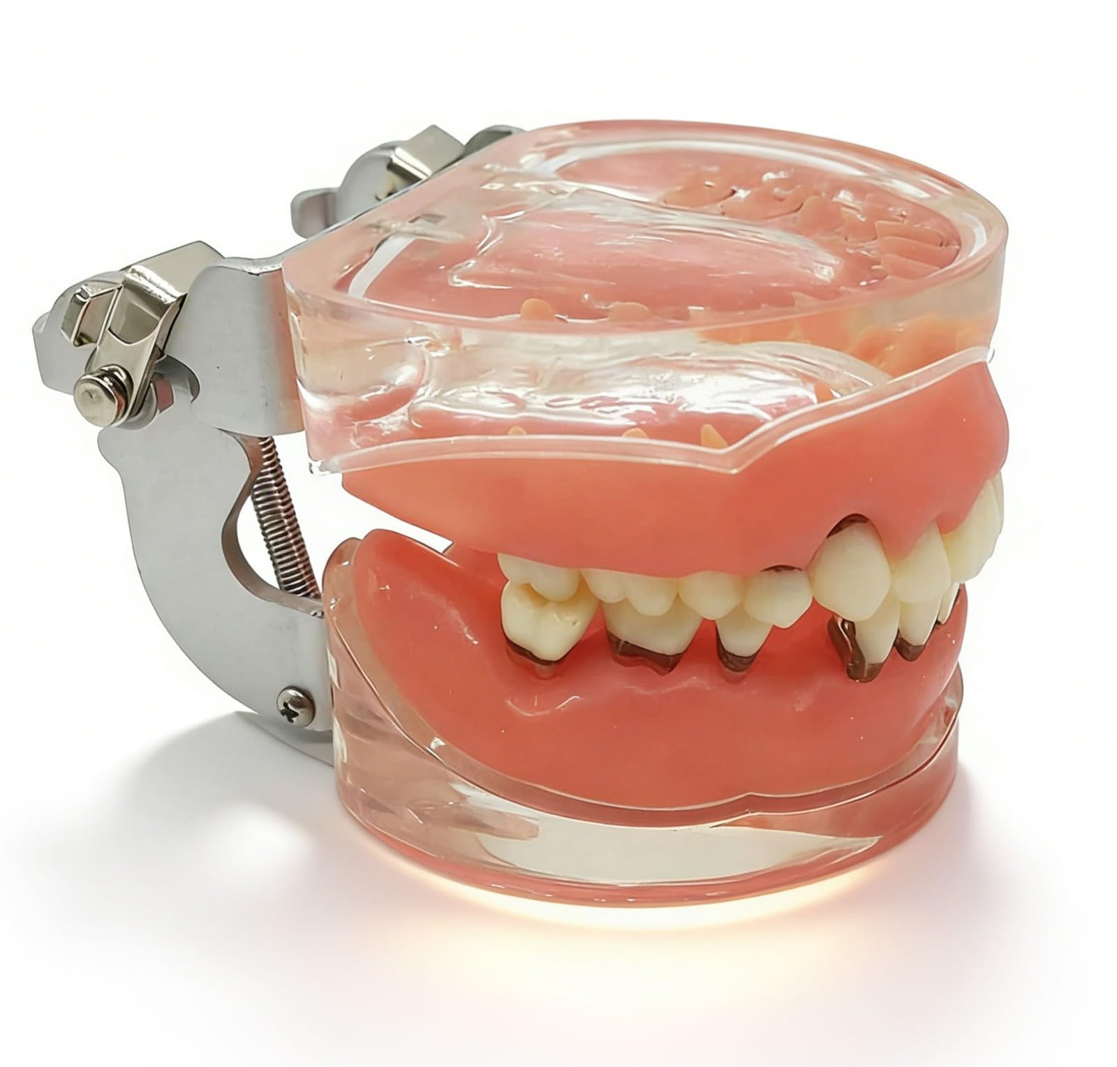 Modèle de dents pour maladies parodontales pour l'éducation, modèle d'enseignement anatomique avec gencives molles et dents amovibles pour démonstrations et entraînement dentaire