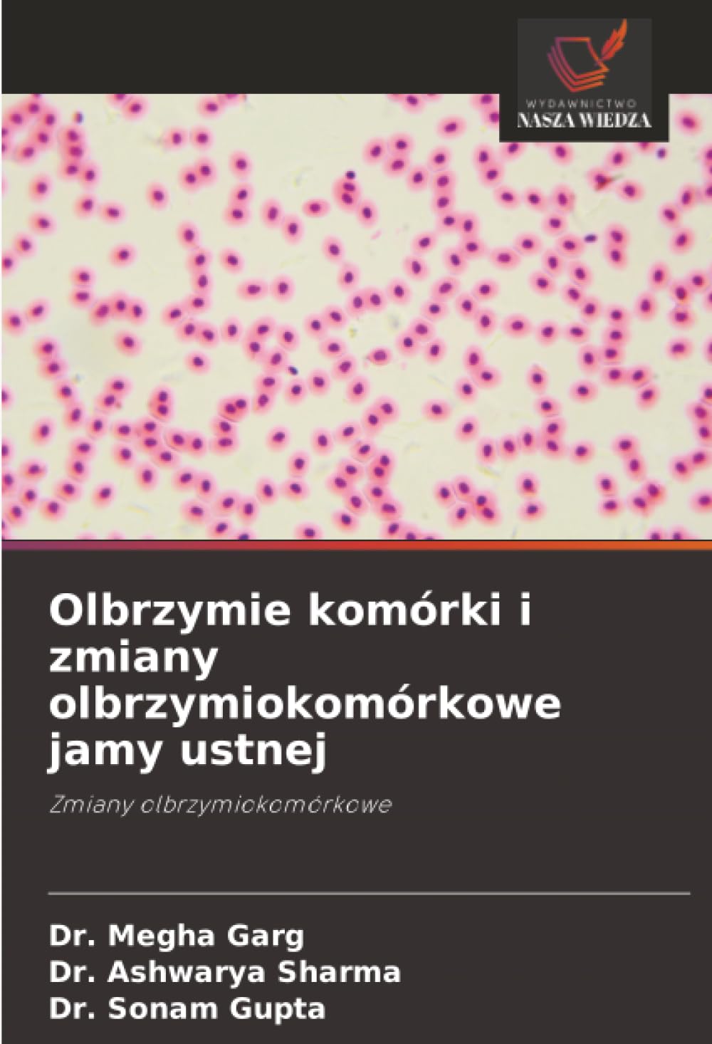 Olbrzymie komórki i zmiany olbrzymiokomórkowe jamy ustnej: Zmiany olbrzymiokomórkowe