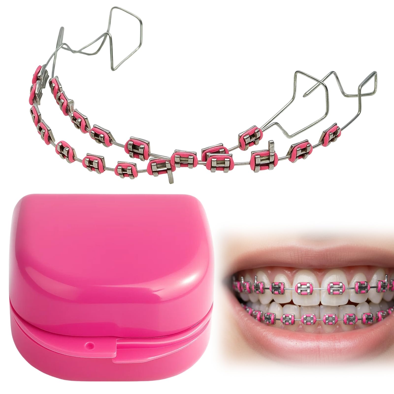 2Pcs Fake Braces Kit, Temporary Tooth Decoration with Metal Wires, Temporary Dental Fake Braces, Teeth Straightening Set with Storage Case, For Dental Students to Practice (Red)