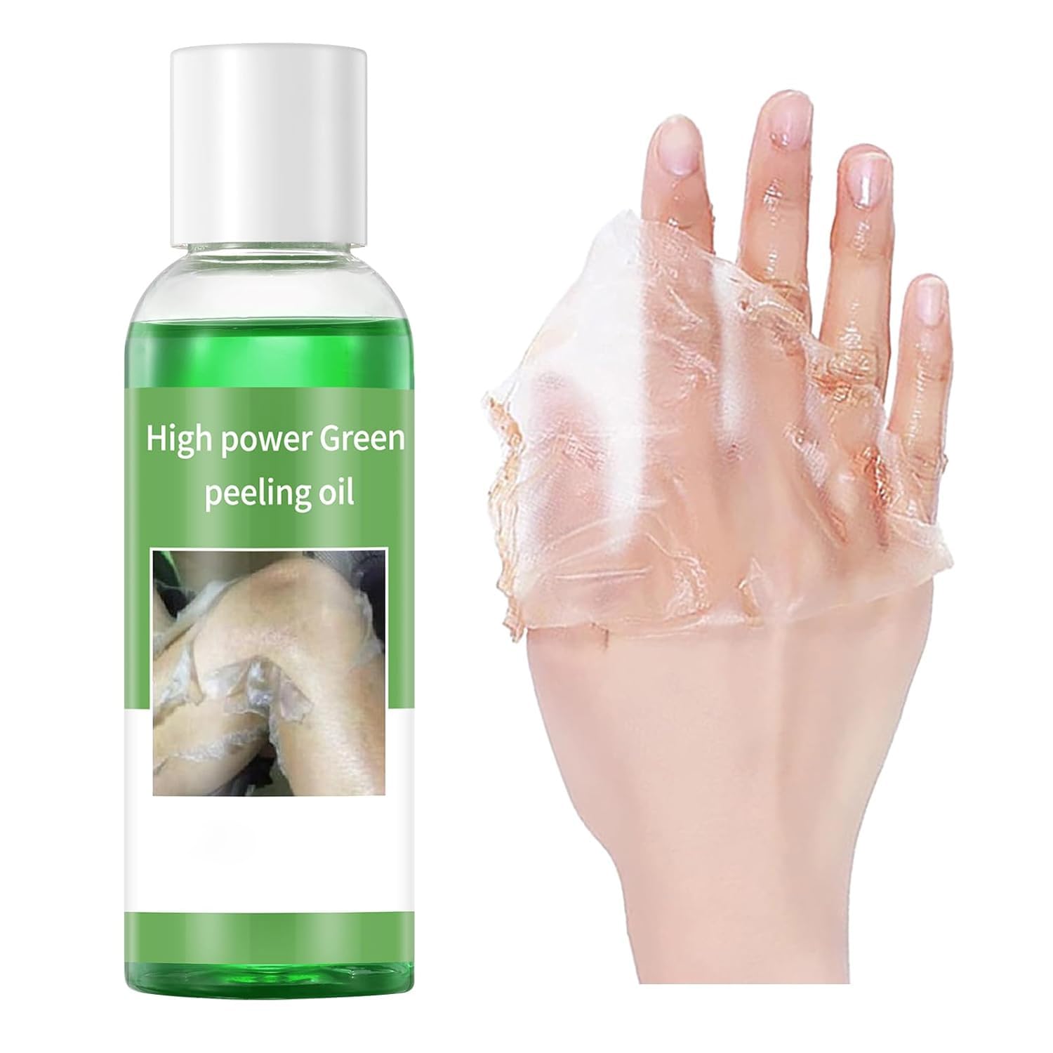 Peeling Oil for Dark Skin Green Peeling Oil Solution Extra Strength Exfoliate Body Extra Strong Exfoliating Peels for Hand Feet Dark Knuckle Knee Elbow Chemical Peel Body for All Skin Type 3.38 FLOZ