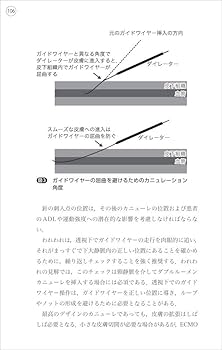 Amazon.com: ECMO実践ハンドブック〜世界標準の成人ECMO管理