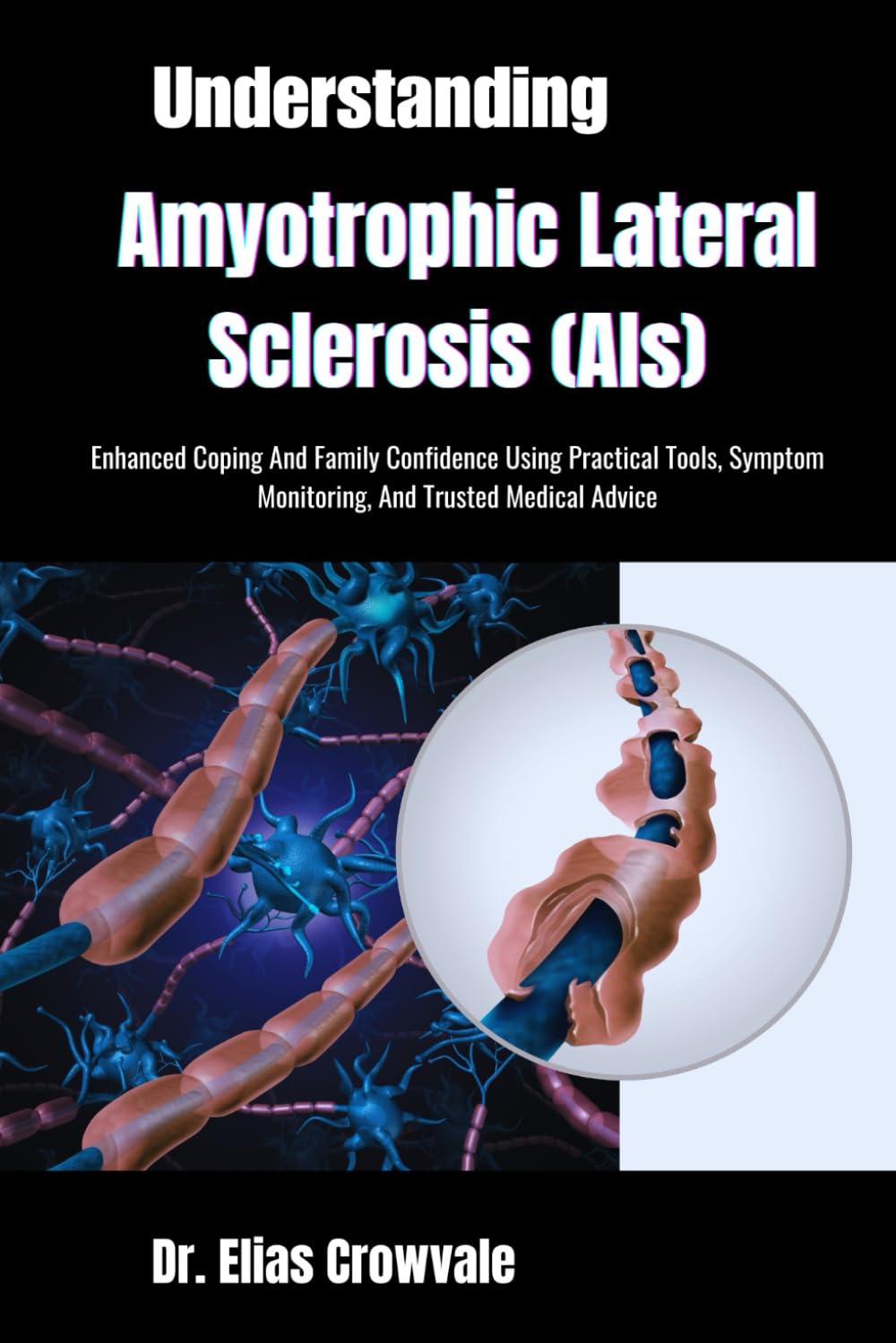 Understanding Amyotrophic Lateral Sclerosis (Als): Enhanced Coping And Family Confidence Using Practical Tools, Symptom Monitoring, And Trusted Medical Advice