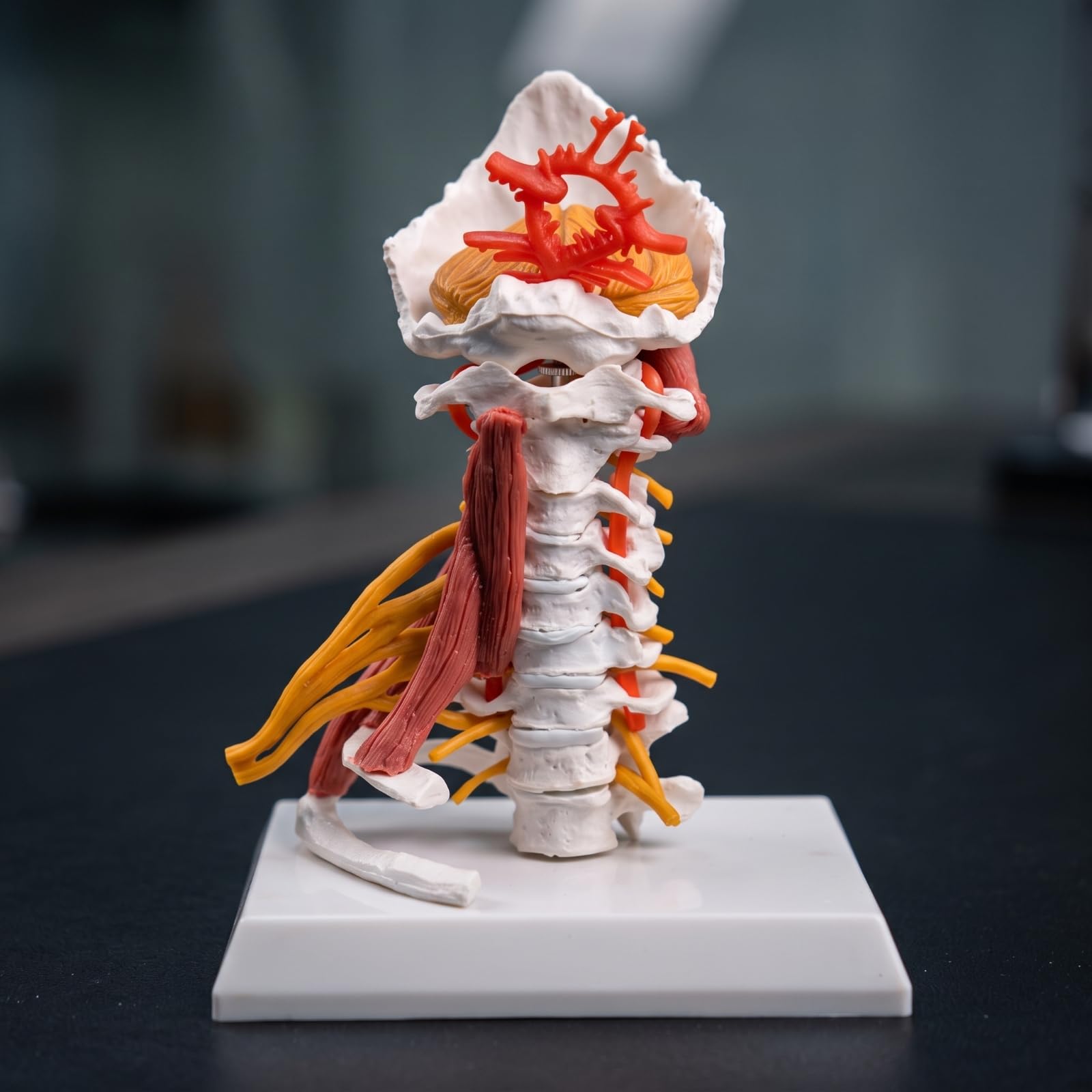 Modello di Vertebra Cervicale con Nervi e Muscoli Smontabile Modello Della Colonna Cervicale Umana Alta Precisione per Studio Medico