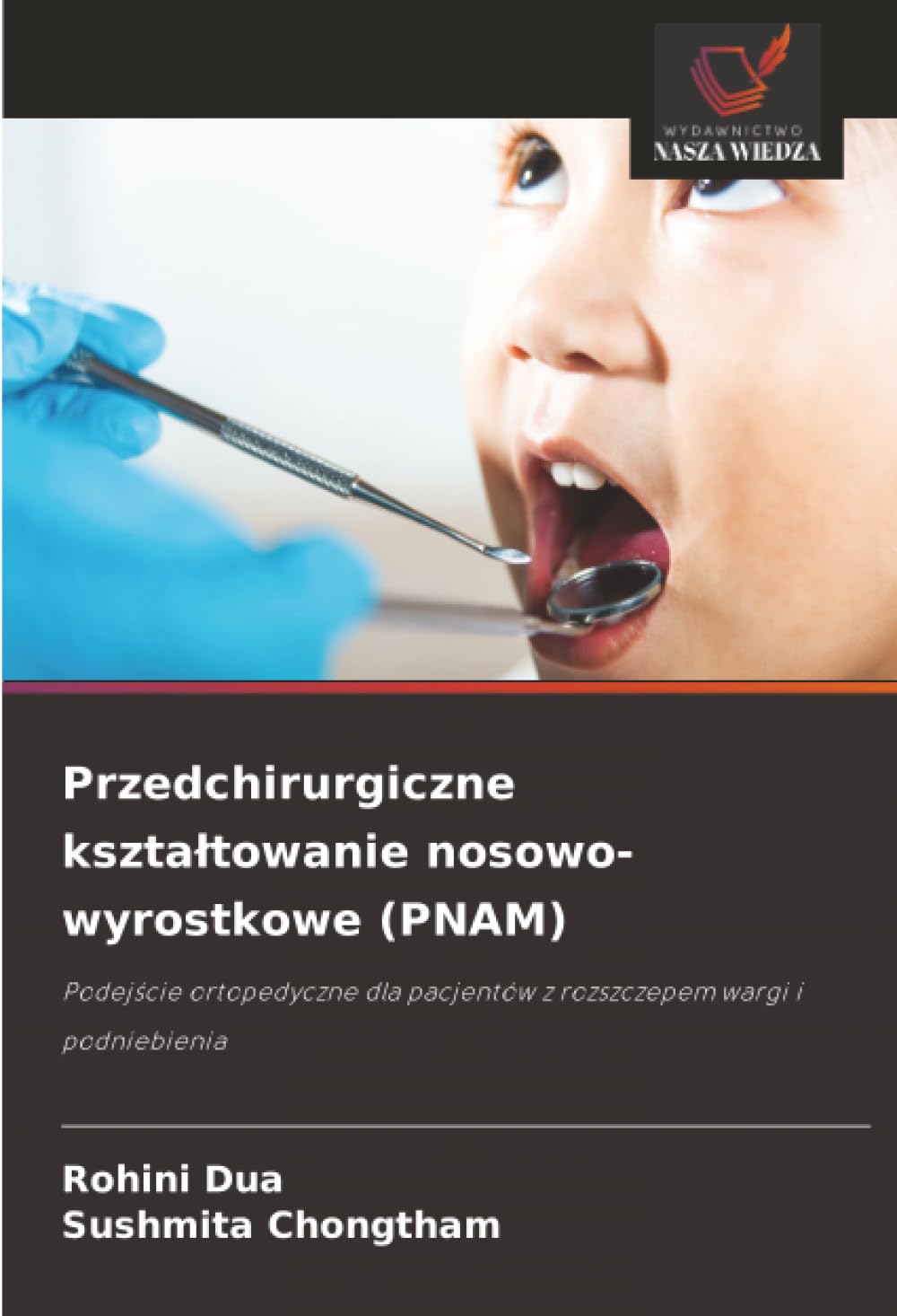 Przedchirurgiczne kszta¿towanie nosowo-wyrostkowe (PNAM): Podej¿cie ortopedyczne dla pacjentów z rozszczepem wargi i podniebienia
