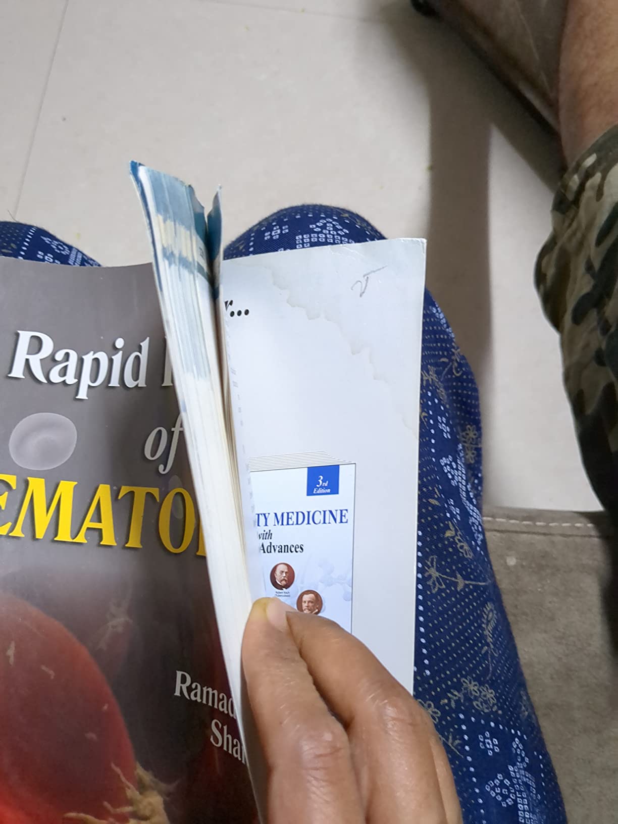 Buy Rapid Review of Hematology Book Online at Low Prices in India ...