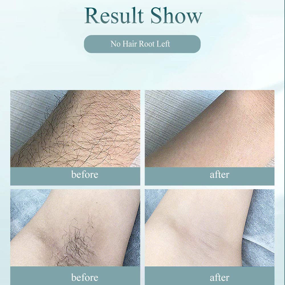 Upgrade to 900,000 flash permanent painless freezing point laser hair removal instrument IPL light skin rejuvenation beauty instrument household electric hair removal instrument for men and women,