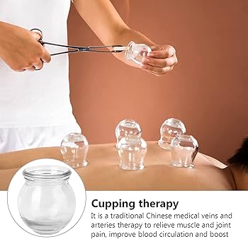 Amazon.co.jp: EIERFSKIOT カッピング セット 吸い玉 6PCSガラス