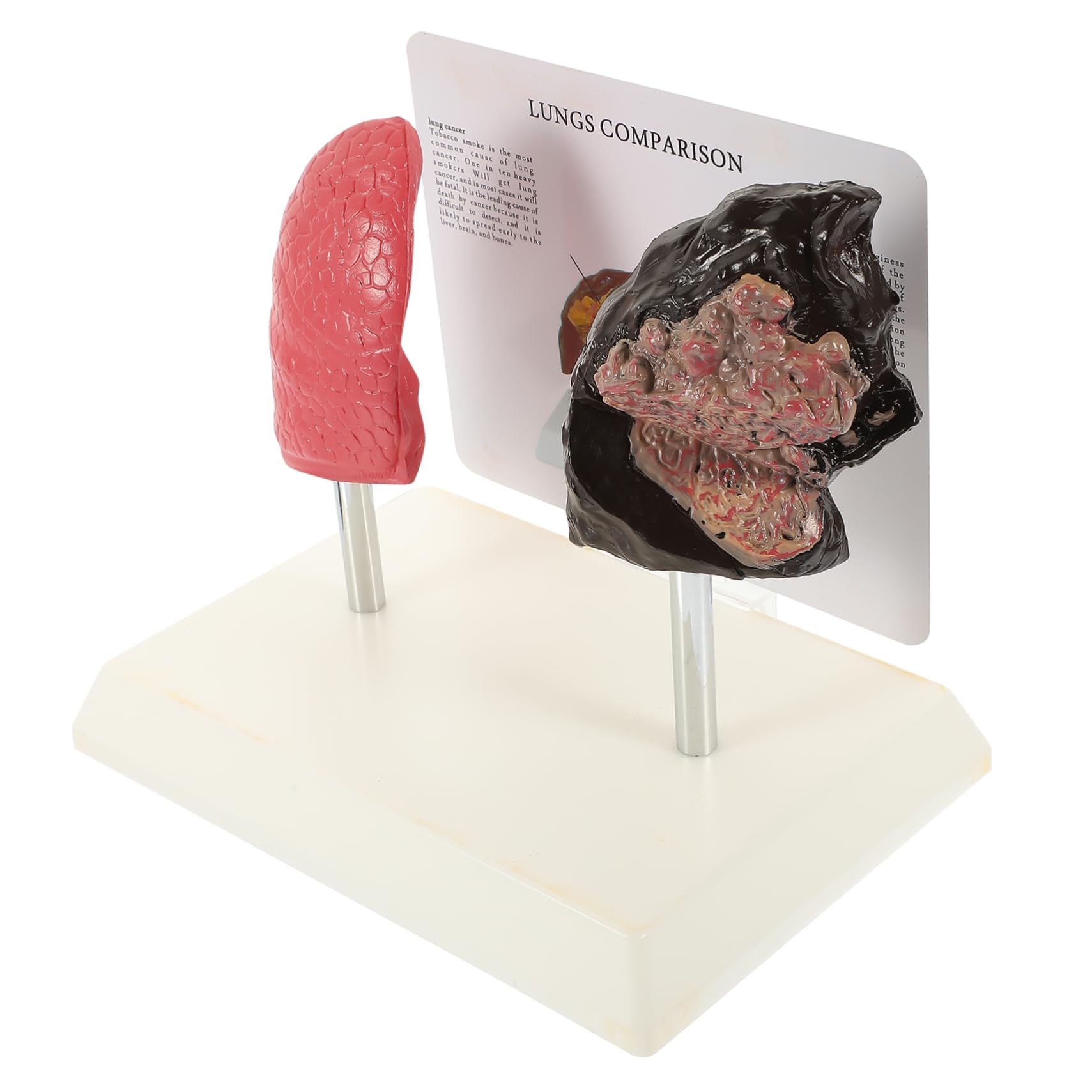 STOBAZA Vivid Respiratory Lung Model Smoking Normal Lung Comparison Medical Anatomy Teaching Tool