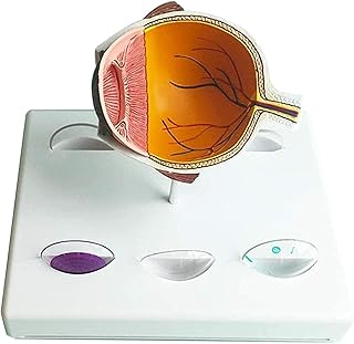 Study Model Educational Model Human Organ Anatomical Model Eye Model - Glaucoma Eye Model - Medical Anatomical Glaucoma Model Medical Pathological Anatomy - for Study Teaching Training SaiFei
