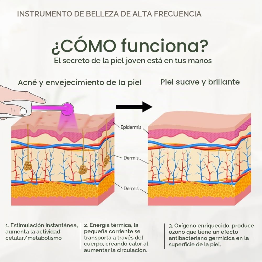 4 en 1 Dispositivo de Belleza de Electroterapia Portátil de Alta Frecuencia Quitamanchas Cuidado de la Piel Spa Derma 4 Violeta Enchufe de la UE