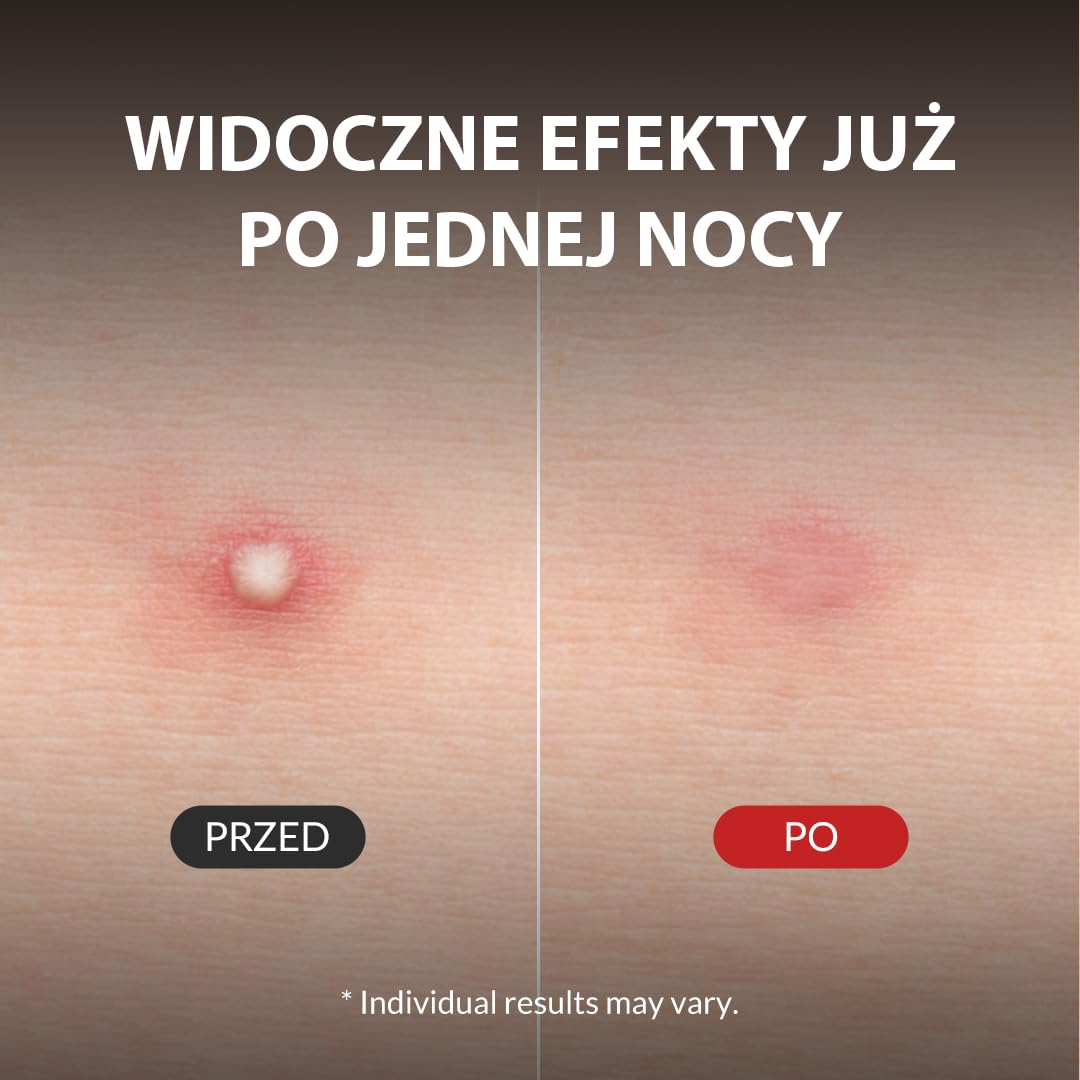 Mizon Good Bye Blemish Clear Patch, Plastry Przeciwtrądzikowe, Pokrywające Pryszcze, Ochronna Nakładka, Wodoodporne, Doskonała Adhezja do Skóry (44 sztuki)