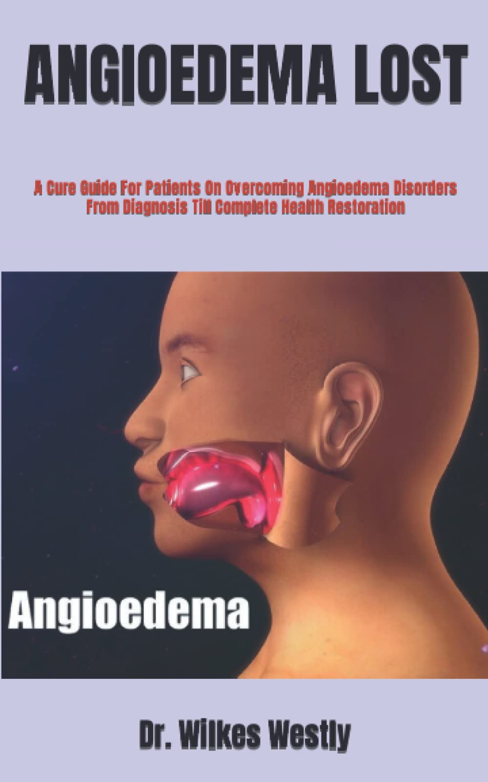 Buy ANGIOEDEMA LOST: A Cure Guide For Patients On Overcoming Angioedema ...