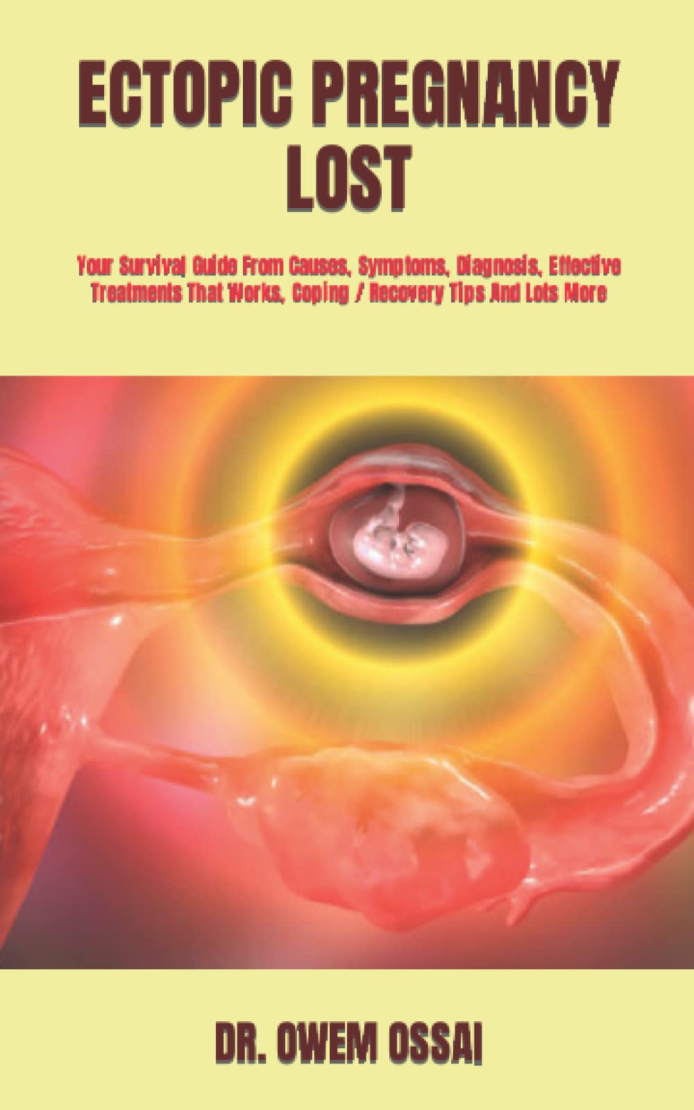 ECTOPIC PREGNANCY LOST: Your Survival Guide From Causes, Symptoms, Diagnosis, Effective Treatments That Works, Coping / Recovery Tips And Lots More