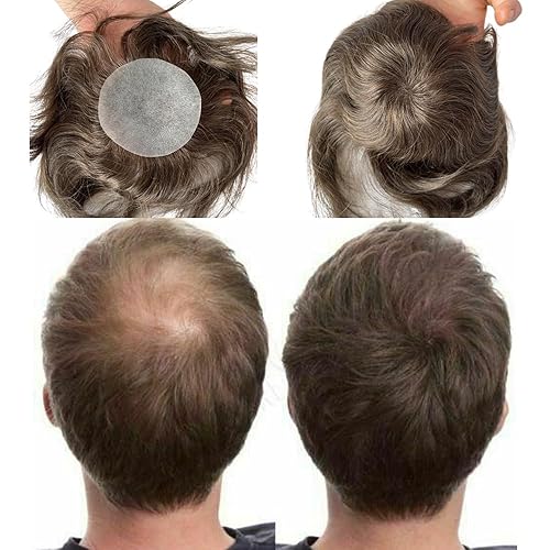 Miniatura 1 de Voloria Parche para el cabello para puntos calvos para hombres, 3.15 x 3.15 pulgadas, parches de pelo completo de poliuretano para cubrir la base de
