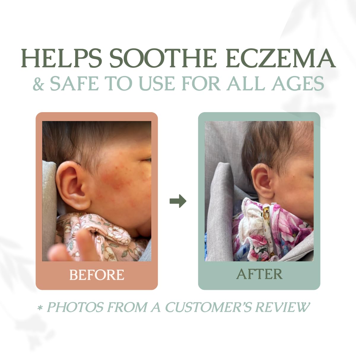 Handmade Whipped Tallow Balm (Unscented/Herb-Infused) - Organic Body Butter with Infused Olive Oil, for Eczema, Rosacea, Baby - 1.3 oz