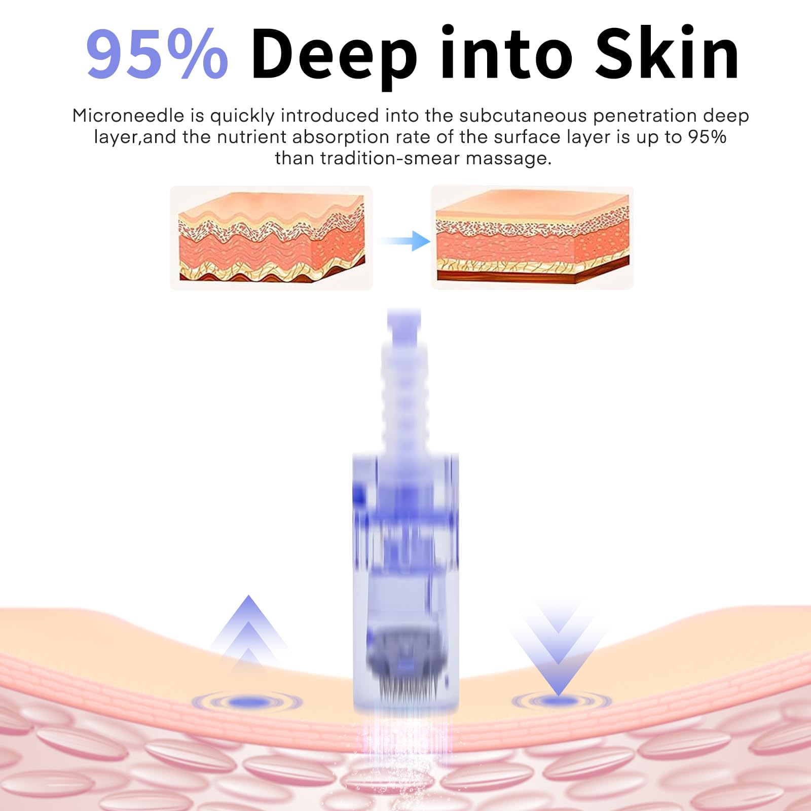 20 Stücke Derma Pen A6 Nadeln 36, Mikronadeln für Elektrische Derma Pen Ultima A6, micro needles