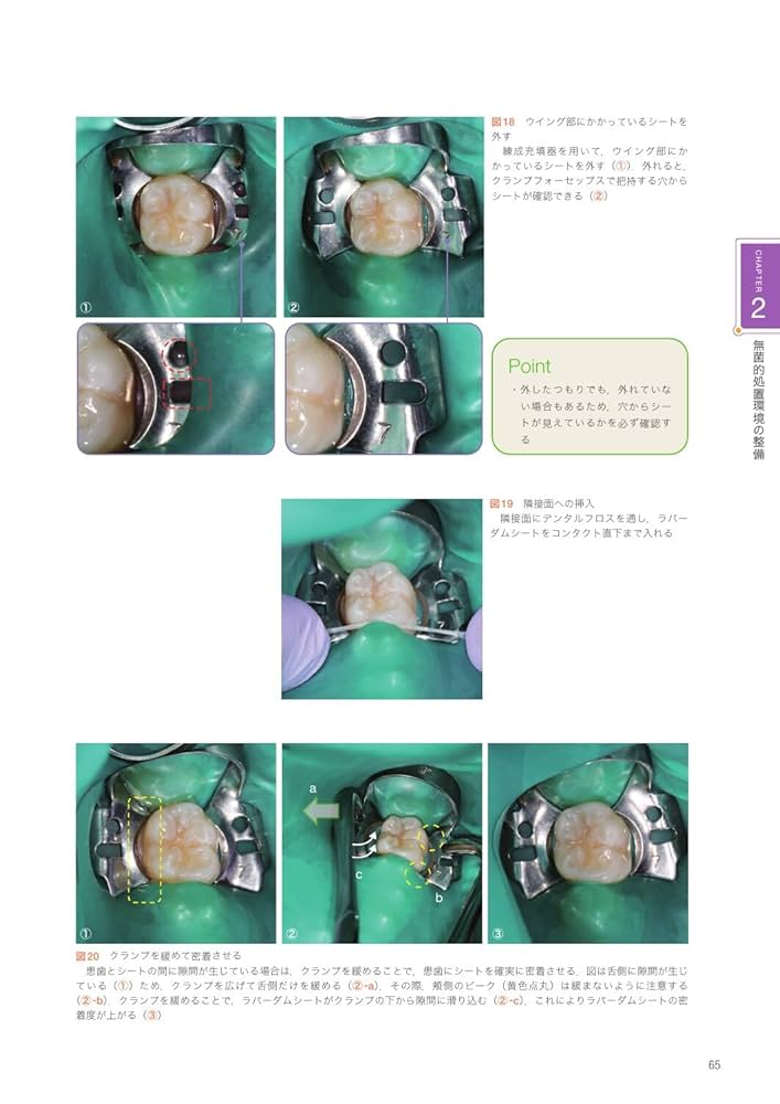 根管治療のクリニカルメソッド 根管治療のクリニカルメソッド | 長谷川 智哉, 木方 一貴, 宮本