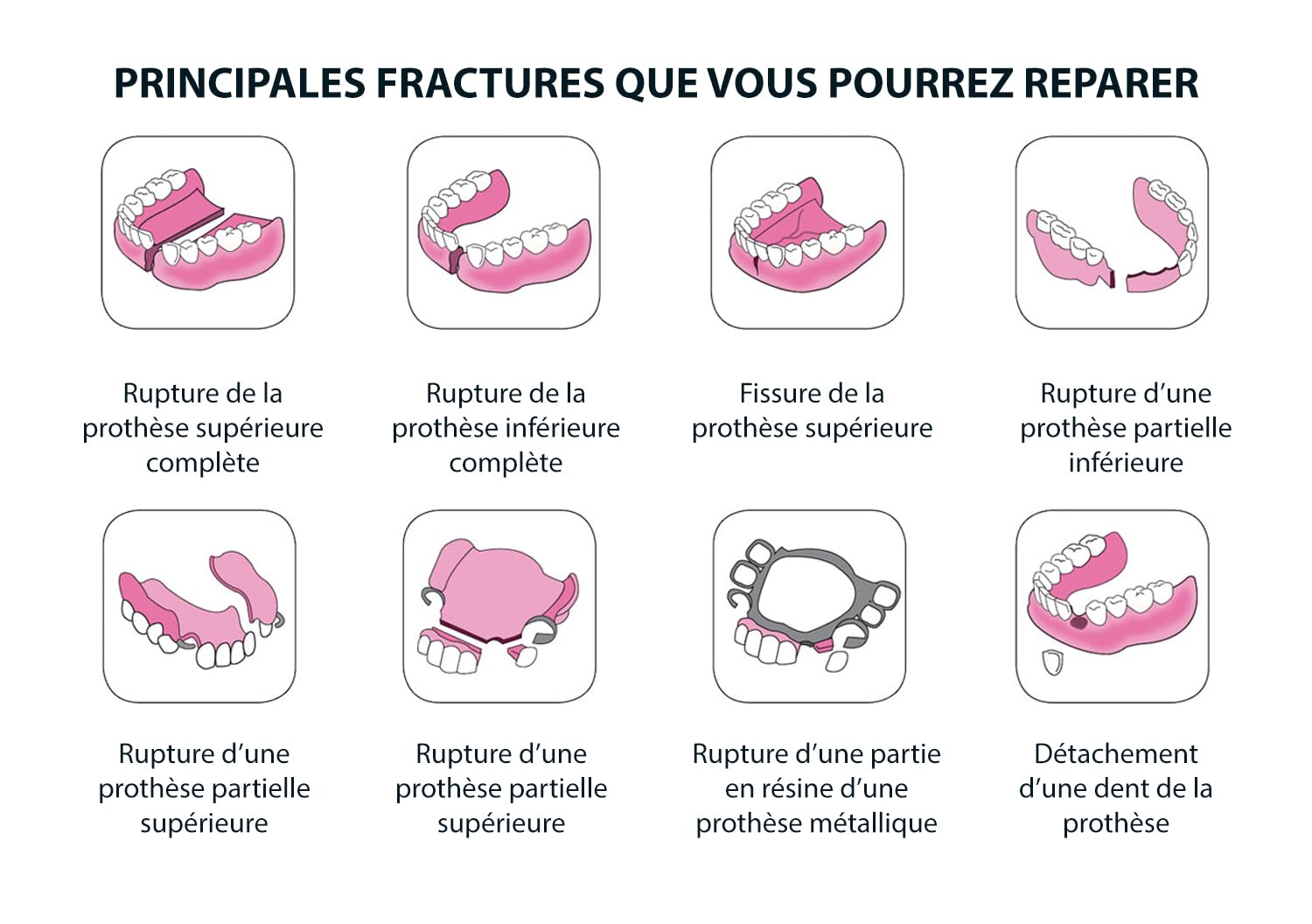 MEDIDENT- SOS REPARATION DENTIER -Réparez votre dentier cassé vous même-Nécessaire pour 3 utilisations